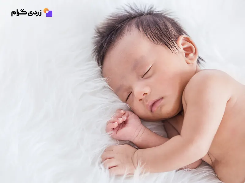 نوزاد در حال خواب با زردی