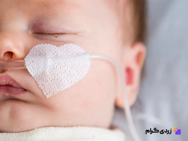 نوزاد دارای زردی