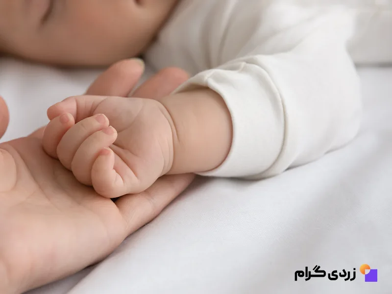 کودک مبتلا زردی نوزاد