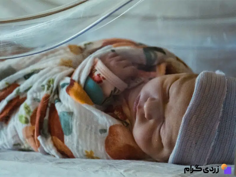 زردی نوزاد