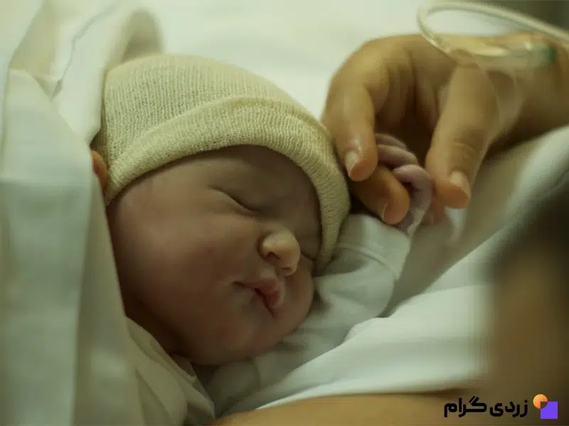 زردی نوزاد